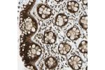 Immunohistochemical staining of human rectum shows strong positivity in nuclear membrane in glandular cells.