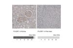 Immunohistochemistry analysis in human kidney and pancreas tissues using HPA012657 antibody. Corresponding PLA2R1 RNA-seq data are presented for the same tissues.