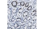 Immunohistochemical staining of human small intestine shows strong nuclear positivity in glandular cells.