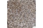 Immunohistochemical staining of human adrenal gland shows positivity in glandular cells.