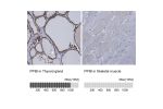 Immunohistochemistry analysis in human thyroid gland and skeletal muscle tissues using HPA012720 antibody. Corresponding PPIB RNA-seq data are presented for the same tissues.