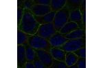 Immunofluorescent staining of human cell line RT4 shows localization to plasma membrane.