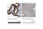 Immunohistochemistry analysis in human gallbladder and skeletal muscle tissues using Anti-SCNN1A antibody. Corresponding SCNN1A RNA-seq data are presented for the same tissues.
