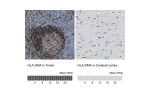 Immunohistochemistry analysis in human tonsil and cerebral cortex tissues using Anti-HLA-DMA antibody. Corresponding HLA-DMA RNA-seq data are presented for the same tissues.