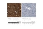 Immunohistochemistry analysis in human cerebral cortex and pancreas tissues using HPA012778 antibody. Corresponding PPP3CA RNA-seq data are presented for the same tissues.