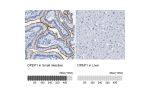 Immunohistochemistry analysis in human small intestine and liver tissues using HPA012783 antibody. Corresponding DPEP1 RNA-seq data are presented for the same tissues.