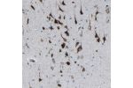 Immunohistochemical staining of human cerebral cortex shows moderate to strong granular cytoplasmic positivity in neurons.
