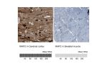 Immunohistochemistry analysis in human cerebral cortex and skeletal muscle tissues using HPA012828 antibody. Corresponding MAP2 RNA-seq data are presented for the same tissues.