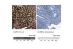 Immunohistochemistry analysis in human liver and endometrium tissues using HPA012852 antibody. Corresponding ASGR1 RNA-seq data are presented for the same tissues.