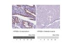 Immunohistochemistry analysis in human endometrium and skeletal muscle tissues using HPA012867 antibody. Corresponding HTR2B RNA-seq data are presented for the same tissues.