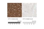 Immunohistochemistry analysis in human cerebral cortex and skeletal muscle tissues using HPA012869 antibody. Corresponding SYT7 RNA-seq data are presented for the same tissues.
