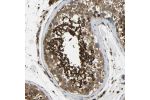 Immunohistochemical staining of human testis shows strong cytoplasmic positivity in cells in seminiferous ducts.