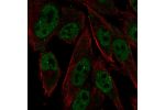 Immunofluorescent staining of human cell line SK-MEL-30 shows localization to nucleoplasm & nuclear bodies.