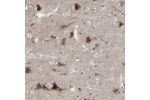 Immunohistochemical staining of human cerebral cortex shows strong cytoplasmic and nuclear positivity in neuronal cells.