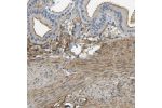 Immunohistochemical staining of human gallbladder shows moderate membranous positivity in glandular cells.