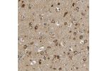Immunohistochemical staining of human cerebral cortex shows strong cytoplasmic positivity in neuronal cells.