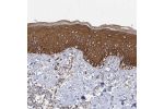 Immunohistochemical staining of human skin shows strong cytoplasmic positivity in squamous epithelial cells.