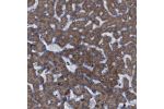 Immunohistochemical staining of human Liver shows strong granular cytoplasmic positivity in hepatocytes.