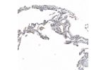 Immunohistochemical staining of human lung shows moderate nuclear positivity in pneumocytes.