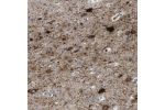 Immunohistochemical staining of human cerebral cortex shows moderate to strong cytoplasmic positivity in neurons.