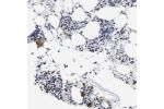 Immunohistochemical staining of human bone marrow shows moderate positivity in megakaryocytes.