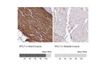 Immunohistochemistry analysis in human heart muscle and skeletal muscle tissues using HPA013331 antibody. Corresponding MYL7 RNA-seq data are presented for the same tissues.