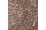 Immunohistochemical staining of human tonsil shows strong membranous positivity in non-germinal center cells.