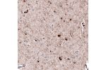Immunohistochemical staining of human cerebral cortex shows moderate positivity in neuronal processes in neuropil.