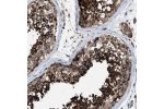 Immunohistochemical staining of human testis shows strong granular cytoplasmic positivity in cells in seminiferous ducts.