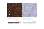 Immunohistochemistry analysis in human cerebral cortex and skeletal muscle tissues using HPA013392 antibody. Corresponding GAP43 RNA-seq data are presented for the same tissues.
