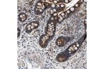 Immunohistochemical staining of human colon shows strong cytoplasmic positivity in glandular cells.