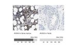 Immunohistochemistry analysis in human bone marrow and testis tissues using HPA013398 antibody. Corresponding ANXA3 RNA-seq data are presented for the same tissues.