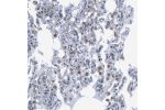 Immunohistochemical staining of human lung shows moderate cytoplasmic positivity.
