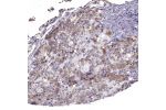 Immunohistochemical staining of human pituitary gland shows moderate cytoplasmic positivity in cells in anterior lobe.