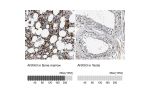 Immunohistochemistry analysis in human bone marrow and testis tissues using HPA013431 antibody. Corresponding ANXA3 RNA-seq data are presented for the same tissues.