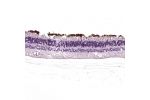 Immunohistochemical staining of human retina shows strong cytoplasmic positivity in rod segments.