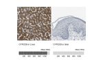 Immunohistochemistry analysis in human liver and skin tissues using HPA013547 antibody. Corresponding CYP2C8 RNA-seq data are presented for the same tissues.
