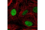 Immunofluorescent staining of human cell line SiHa shows localization to nucleoplasm.