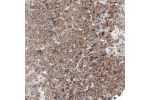 Immunohistochemical staining of human liver shows moderate membranous positivity in hepatocytes.