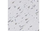 Immunohistochemical staining of human hippocampus shows moderate cytoplasmic positivity in neuronal cells.