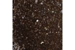 Immunohistochemical staining of human lymph node shows strong cytoplasmic positivity in reaction center cells, lymphoid cells outside reaction centra.