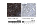 Immunohistochemistry analysis in human lymph node and skeletal muscle tissues using HPA013707 antibody. Corresponding ADGRE5 RNA-seq data are presented for the same tissues.
