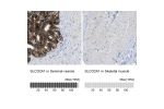 Immunohistochemistry analysis in human seminal vesicle and skeletal muscle tissues using HPA013742 antibody. Corresponding SLCO2A1 RNA-seq data are presented for the same tissues.