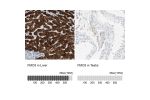 Immunohistochemistry analysis in human liver and testis tissues using HPA013750 antibody. Corresponding FMO3 RNA-seq data are presented for the same tissues.