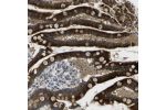 Immunohistochemical staining of human colon shows strong cytoplasmic positivity in glandular cells.