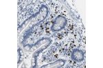 Immunohistochemical staining of human colon shows strong cytoplasmic positivity in lymphoid cells.