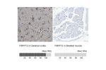 Immunohistochemistry analysis in human cerebral cortex and skeletal muscle tissues using HPA013796 antibody. Corresponding P2RY12 RNA-seq data are presented for the same tissues.
