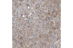 Immunohistochemical staining of human liver shows moderate cytoplasmic positivity in hepatocytes.