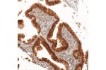 Immunohistochemical staining of human fallopian tube shows moderate nuclear and cytoplasmic positivity in glandular cells.
