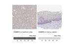 Immunohistochemistry analysis in human cerebral cortex and cervix, uterine tissues using HPA013820 antibody. Corresponding GABBR2 RNA-seq data are presented for the same tissues.